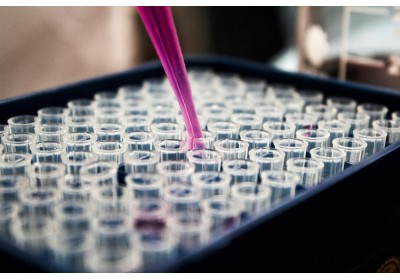 Analyse du paracétamol par chromatographie : Un outil essentiel pour identifier les contrefaçons image