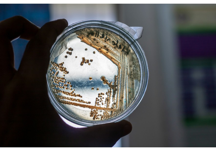 Contrefaçon d'antibiotique : Un péril silencieux pour la santé mondiale