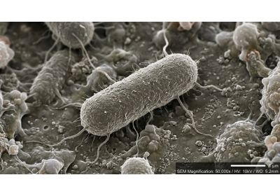 Antibiorésistance et contrefaçon d'antibiotique : un péril sanitaire majeur image