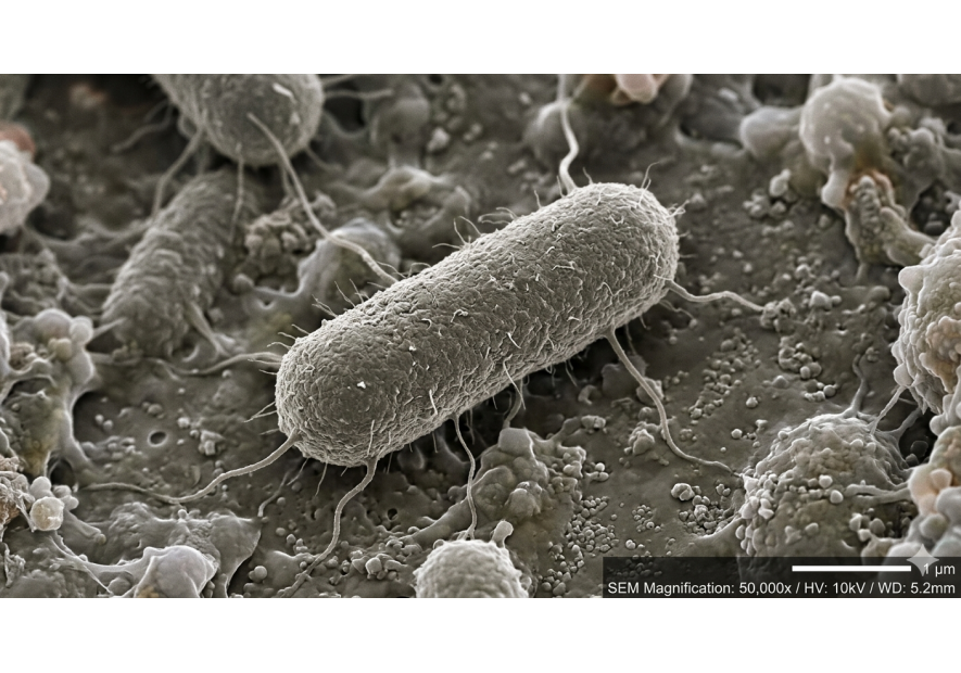 Antibiorésistance et contrefaçon d'antibiotique : un péril sanitaire majeur